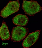 Immunofluorescent staining of human A549 cells with ALOX12 antibody (green) and anti-Actin (red).