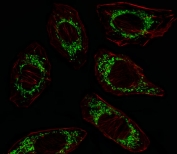 Immunofluorescent staining of fixed and permeabilized human A549 cells with OAT antibody (green) and anti-Actin (red).