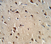 IHC testing of FFPE human brain tissue with OAT antibody. HIER: steam section in pH6 citrate buffer for 20 min and allow to cool prior to staining.