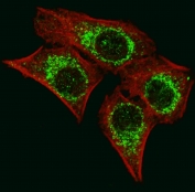 Immunofluorescent staining of fixed and permeabilized human U-251 cells with AIF antibody (green) and anti-Actin (red).