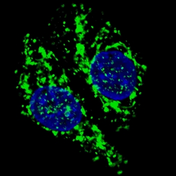 Immunofluorescent staining of fixed and permeabilized Chloroquine-treated human U-251 cells with AIF antibody (green) and DAPI (blue).