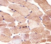IHC testing of FFPE human skeletal muscle tissue with CARD6 antibody. HIER: steam section in pH6 citrate buffer for 20 min and allow to cool prior to staining.