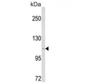 Western blot testing of human MDA-MB-231 cell lysate with CARD6 antibody. Predicted molecular weight ~116 kDa.