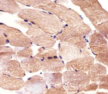 IHC testing of FFPE human skeletal muscle tissue with CARD6 antibody. HIER: steam section in pH6 citrate buffer for 20 min and allow to cool prior to staining.