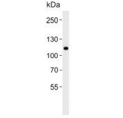 Western blot testing of human WiDr cell lysate with CARD6 antibody. Predicted molecular weight ~116 kDa.