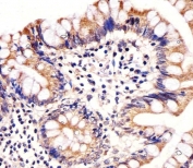 IHC testing of FFPE human colon tissue with CARD6 antibody. HIER: steam section in pH6 citrate buffer for 20 min and allow to cool prior to staining.