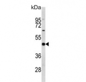 Western blot testing of human K562 cell lysate with EIF4A2 antibody. Predicted molecular weight ~46 kDa.
