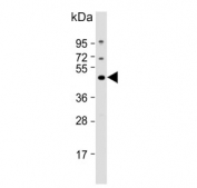 Western blot testing of human MCF7 cell lysate with EIF4A2 antibody. Predicted molecular weight ~46 kDa.