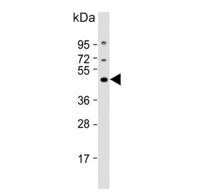 Western blot testing of human MCF7 cell lysate with EIF4A2 antibody. Predicted molecular weight ~46 kDa.