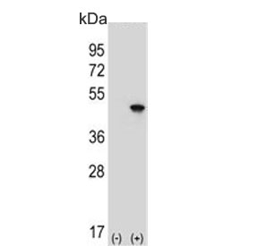 Western blot testing of 1) non-transfected and 2) transfected 293 cell lysate with EIF4A2 antibody.