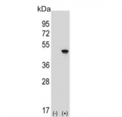 Western blot testing of 1) non-transfected and 2) transfected 293 cell lysate with EIF4A2 antibody.