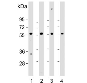 Western blot testing of human 1) heart, 2) HEK293, 3) U-87 MG and 4) brain lysate with ENTPD2 antibody. Predicted molecular weight ~54 kDa.