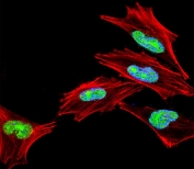 Immunofluorescent staining of fixed and permeabilized human A2058 cells with TBX1 antibody (green), DAPI nuclear stain (blue) and anti-Actin (red).