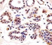 IHC testing of FFPE human breast tissue with TBX1 antibody. HIER: steam section in pH6 citrate buffer for 20 min and allow to cool prior to staining.