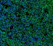 Immunofluorescent staining of FFPE human spleen tissue with IL2 Receptor gamma antibody (green) and DAPI nuclear stain (blue).