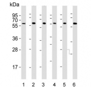 Western blot testing of human 1) spleen, 2) Jurkat, 3) Daudi, 4) KG1, 5) MOLT4 and 6) HL60 cell lysate with IL2 Receptor gamma antibody. Expected molecular weight: 42-69 kDa depending on glycosylation level.