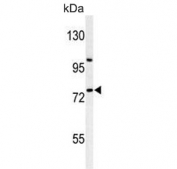 Western blot testing of human HepG2 cell lysate with ZNF202 antibody. Predicted molecular weight ~75 kDa.