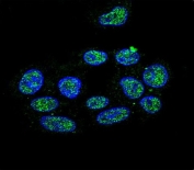 Immunofluorescent staining of human HepG2 cells with ZNF202 antibody (green) and DAPI nuclear stain (blue).
