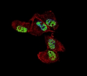 Immunofluorescent staining of fixed and permeabilized human MDA-MB-231 cells with ZNF202 antibody (green), DAPI nuclear stain (blue) and anti-Actin (red).