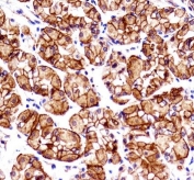 IHC testing of FFPE human stomach tissue with Catenin Beta antibody. HIER: steam section in pH6 citrate buffer for 20 min and allow to cool prior to staining.