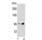 Western blot testing of human 1) HEK293 and 2) T-47D cell lysate with Catenin Beta antibody. Predicted molecular weight ~85 kDa, but routinely observed at 90-95 kDa.