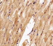 IHC testing of FFPE human skeletal muscle tissue with hsp90a.1 antibody. HIER: steam section in pH6 citrate buffer for 20 min and allow to cool prior to staining.
