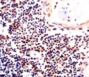 IHC testing of FFPE human thymus tissue with Histone H2AX antibody. HIER: steam section in pH6 citrate buffer for 20 min and allow to cool prior to staining.