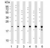Western blot testing of human 1) Jurkat, 2) A431, 3) MDA-MB-231, 4) Raji, 5) Jurkat and 6) ThP-1 cell lysate with BID antibody. Predicted molecular weight ~22 kDa.