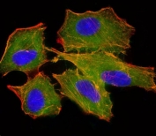 Immunofluorescent staining of fixed and permeabilized human A549 cells with BID antibody (green), DAPI nuclear stain (blue) and anti-Actin (red).