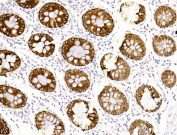 IHC testing of FFPE human colon tissue with Keratin 19 antibody. HIER: steam section in pH6 citrate buffer for 20 min and allow to cool prior to staining.