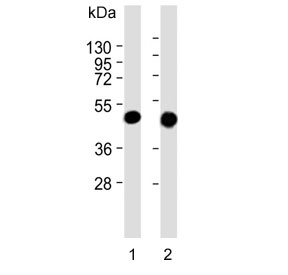 Western blot testing of human 1) HepG2 and 2) MCF7 cell lysate with Keratin 19 antibody. Predicted molecular weight ~43 kDa.