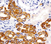 IHC testing of FFPE human kidney tissue with Keratin 19 antibody. HIER: steam section in pH6 citrate buffer for 20 min and allow to cool prior to staining.