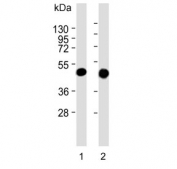 Western blot testing of human 1) HepG2 and 2) MCF7 cell lysate with Keratin 19 antibody. Predicted molecular weight ~43 kDa.