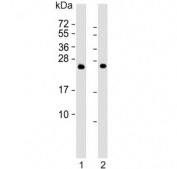 Western blot testing of 1) mouse brain and 2) rat brain lysate with RAB3A antibody. Predicted molecular weight ~25 kDa.