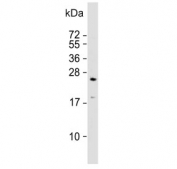 Western blot testing of human brain lysate with RAB3A antibody. Predicted molecular weight ~25 kDa.
