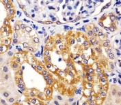 IHC testing of FFPE human kidney tissue with IRF3 antibody. HIER: steam section in pH6 citrate buffer for 20 min and allow to cool prior to staining.