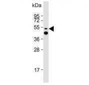 Western blot testing of human Jurkat cell lysate with LCK antibody. Predicted molecular weight ~58 kDa.