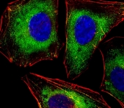 Immunofluorescent staining of fixed and permeabilized human HeLa cells with LCK antibody (green), DAPI nuclear stain (blue) and anti-Actin (red).