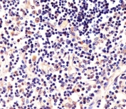 IHC testing of FFPE human thymus tissue with LCK antibody. HIER: steam section in pH6 citrate buffer for 20 min and allow to cool prior to staining.