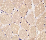 IHC testing of FFPE human skeletal muscle tissue with Density Regulated Protein antibody. HIER: steam section in pH6 citrate buffer for 20 min and allow to cool prior to staining.