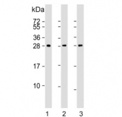 Western blot testing of human 1) A431, 2) skeletal muscle and 3) brain lysate with Density Regulated Protein antibody. Expected molecular weight ~22 kDa (unmodified), 27-31 kDa (modified).