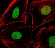 Immunofluorescent staining of fixed and permeabilized human HeLa cells with APE1 antibody (green) and anti-Actin (red).
