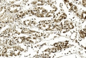 IHC testing of FFPE human stomach tissue with APE1 antibody. HIER: steam section in pH6 citrate buffer for 20 min and allow to cool prior to staining.