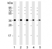 Western blot testing of human 1) A431, 2) HeLa, 3) HepG2, 4) K562 and 5) PC-3 cell lysate with APE1 antibody. Predicted molecular weight ~38 kDa.