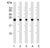 Western blot testing of 1) human brain, 2) human HeLa, 3) human MCF7, 4) mouse NIH 3T3 and 5) human SH-SY5Y lysate with Superoxide Dismutase 2 antibody. Predicted molecular weight ~25 kDa.