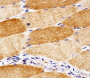 IHC testing of FFPE human skeletal muscle tissue with Superoxide Dismutase 2 antibody. HIER: steam section in pH6 citrate buffer for 20 min and allow to cool prior to staining.