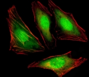 Immunofluorescent staining of fixed and permeabilized human HeLa cells with VCP antibody (green) and anti-Actin (red).