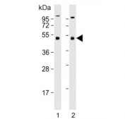 Western blot testing of human 1) Jurkat and 2) K562 cell lysate with MKRN2 antibody. Predicted molecular weight ~47 kDa.