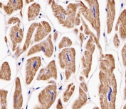 IHC testing of FFPE human heart tissue with MKRN2 antibody. HIER: steam section in pH6 citrate buffer for 20 min and allow to cool prior to staining.