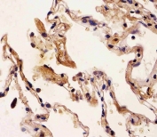 IHC testing of FFPE human lung tissue with S100A2 antibody. HIER: steam section in pH6 citrate buffer for 20 min and allow to cool prior to staining.